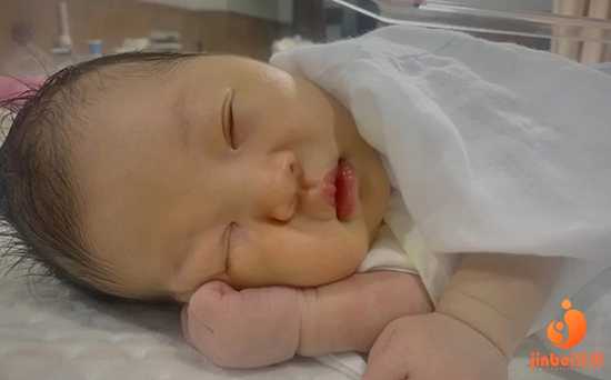 【郑州有做供卵试管婴儿的医院吗】经历两次胎停卵泡萎缩，现在已生健康宝宝